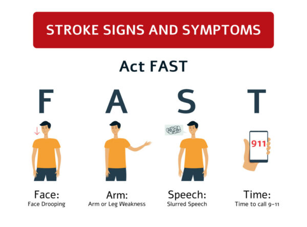 STROKES WHAT YOU SHOULD KNOW | Mens Clinic International